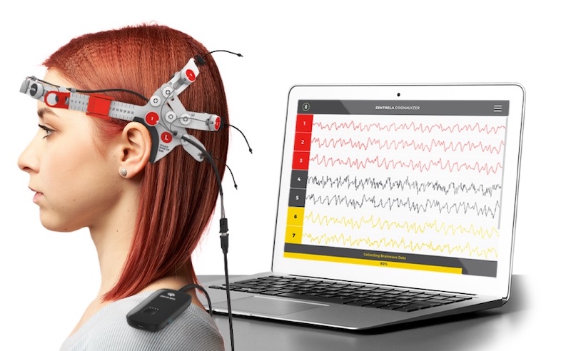 Canadian Neurotechnology Company Zentrela Launches Groundbreaking Education Program on Cannabis Product Effects Based on Novel Brainwave Research